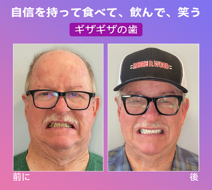 𝐉𝐚𝐬𝐬𝐞𝐞𝐦®🐼新世代の快適な義歯(🦷期間限定割引 残り30分🦷)