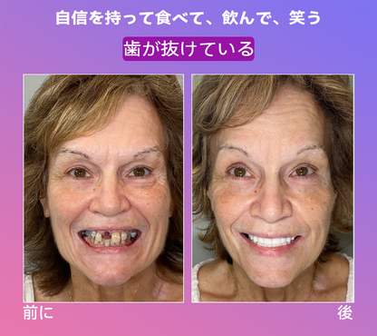 𝐉𝐚𝐬𝐬𝐞𝐞𝐦®🐼新世代の快適な義歯(🦷期間限定割引 残り30分🦷)