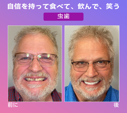 𝐉𝐚𝐬𝐬𝐞𝐞𝐦®🐼新世代の快適な義歯(🦷期間限定割引 残り30分🦷)